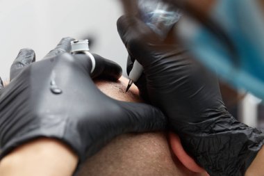 Adam kafasına - tricopigmentation kalıcı makyaj yapma güzellik uzmanı