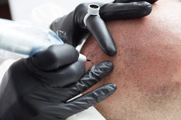 Adam kafasına - tricopigmentation kalıcı makyaj yapma güzellik uzmanı