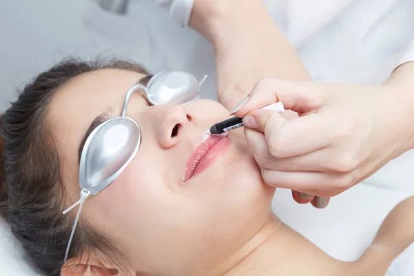 Kosmetolog ger epilering Laser behandling till kvinna på läppar — Stockfoto