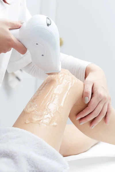 Beautician δίνοντας θεραπεία με λέιζερ Epilation για τη γυναίκα στο Thigh — Φωτογραφία Αρχείου