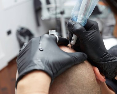 Erkek deri kafa - güzellik uzmanı yapım kalıcı makyaj tricopigmentation uygulama