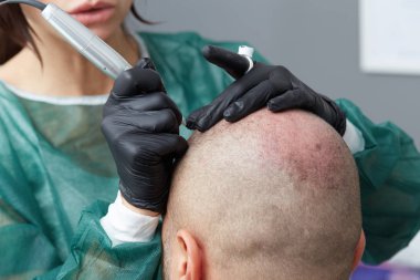kalıcı makyaj - tricopigmentation yapım profesyonel dövmeci