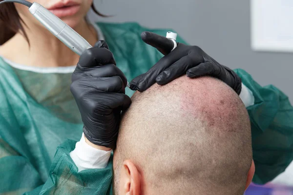 Professional tattooist making permanent make up - tricopigmentation — Stock Photo, Image