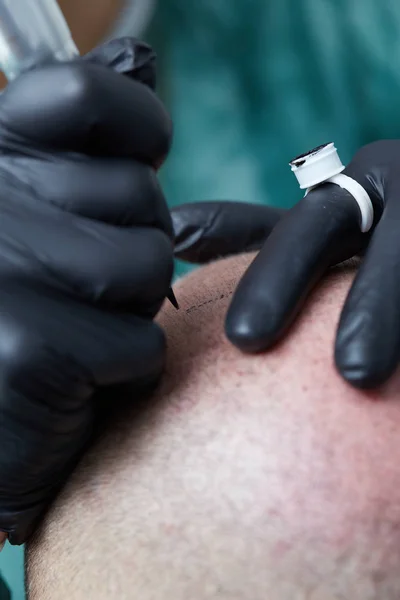 Profesional tato membuat permanen make up di kepala manusia tricopigmentation — Stok Foto