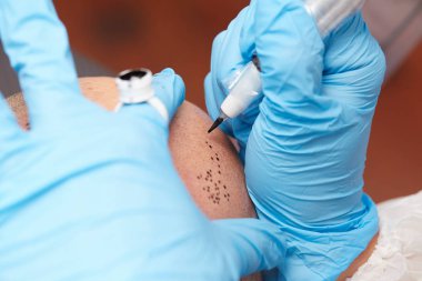 profesyonel dövmeci kalıcı hale getirme tricopigmentation kadar yapmak