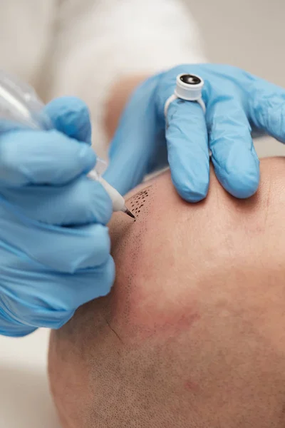 Ahli tato profesional membuat tricopigmentasi permanen — Stok Foto