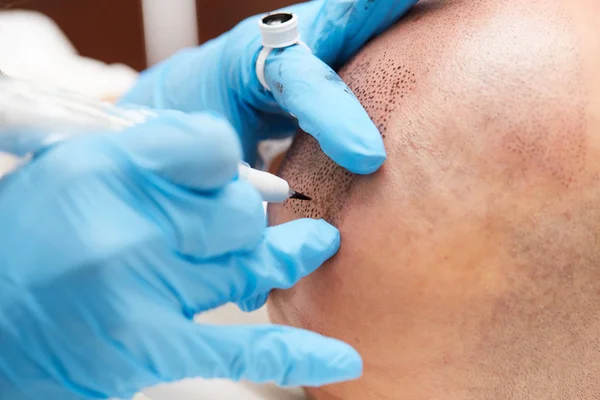 Professionele tatoeëerder maken van permanente make-up tricopigmentation — Stockfoto