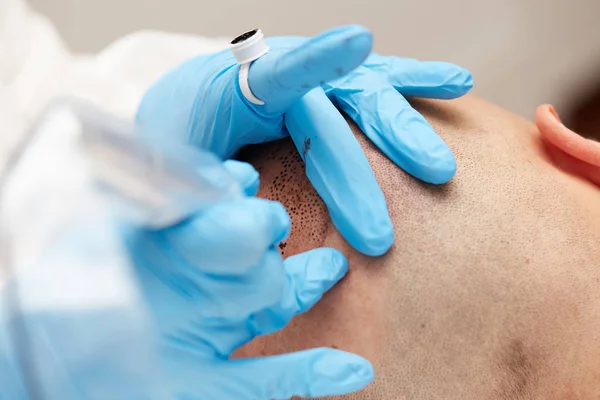 Professionele tatoeëerder maken van permanente make-up tricopigmentation — Stockfoto