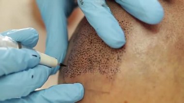profesyonel dövmeci kalıcı hale getirme tricopigmentation kadar yapmak