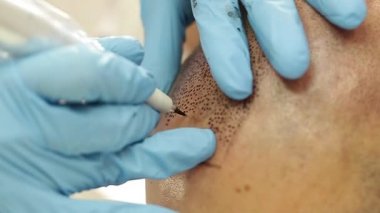 profesyonel dövmeci kalıcı hale getirme tricopigmentation kadar yapmak