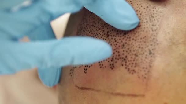 Tatuador profissional fazendo permanente compõem tricopigmentation — Vídeo de Stock