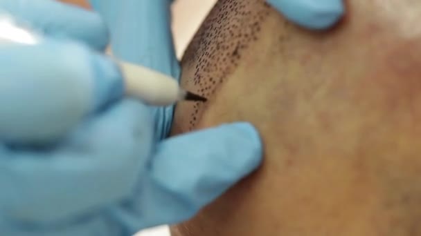 Professionele tatoeëerder maken van permanente make-up tricopigmentation Videoclip