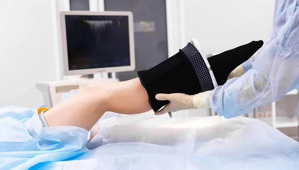 Surger 以前の病院で下肢静脈瘤からストッキングの脚 — ストック写真