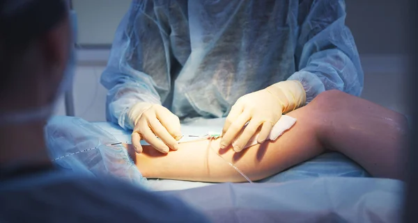 Cirurgia Médica Perna Varizes Cirurgia Vascular — Fotografia de Stock