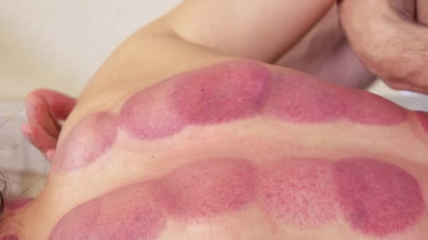 Massage schultern von mädchen — Stockvideo