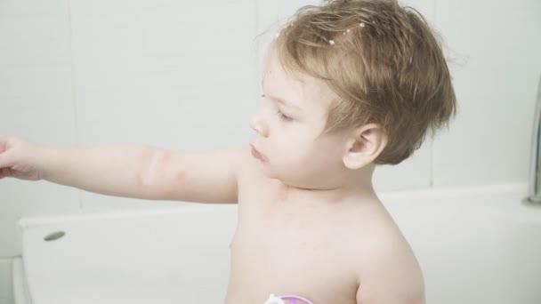 Хлопчик з алергією — стокове відео