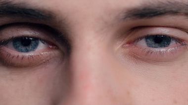 Genç closeup sorunlu cilt akne ve seçici odak ile mavi gözlü adamın. Mavi gözlü - Obs genç bir adam portresi yakın çekim: model kullanımı objektif temas. İnsan gözü ayrıntı. İnsan gözü