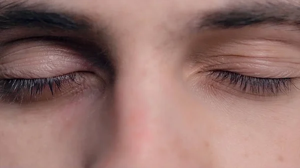 Zbliżenie młodych mans niebieskie oczy z trądzikiem problematyczne skóry i Selektywny fokus. Close-up portret młodego mężczyzny z niebieskimi oczami - Obs: modelu obiektywu kontakt. Ludzkie oko wszystko. Ludzkiego oka — Zdjęcie stockowe