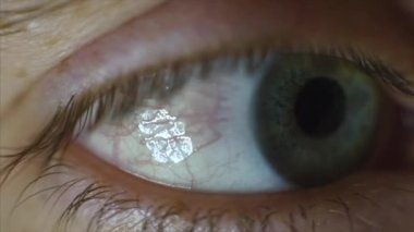 Gözler yakın çekim mans. Video. Close-Up göz, gergin hareketi mans. Öğrenci etrafına bakıyor