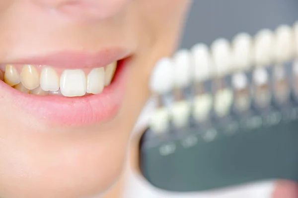 Signora sorridente accanto a campioni di denti — Foto Stock