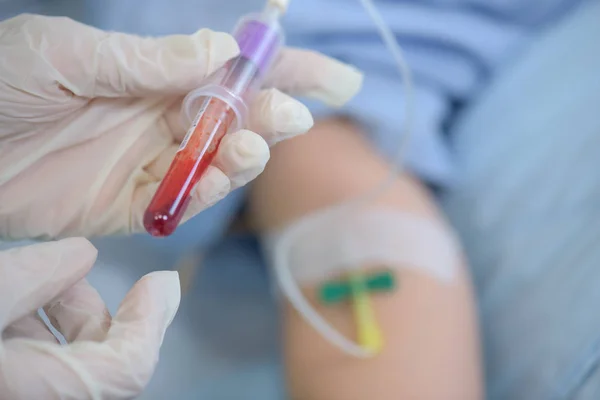 Extrair sangue do doente — Fotografia de Stock