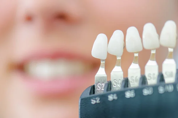 Numbered individual false teeth for colour match — Stock Photo, Image
