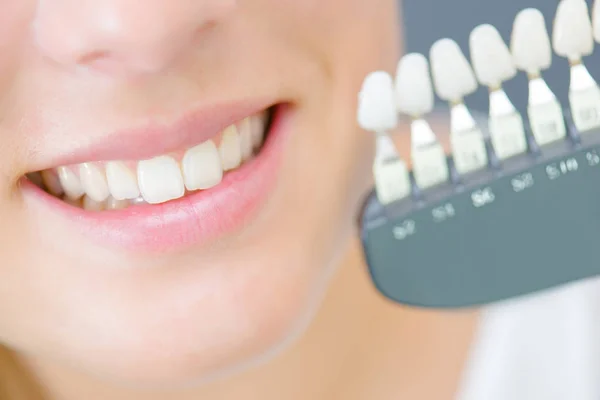 Detailní záběr zubů — Stock fotografie