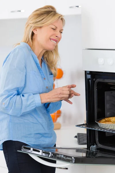 Queima de cozinha na mão causada pelo forno de aquecimento — Fotografia de Stock