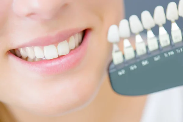 Dientes artificiales y artificiales — Foto de Stock