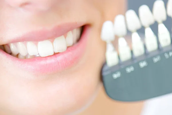 Señora sosteniendo muestras de dientes — Foto de Stock