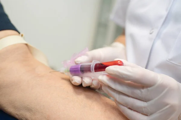 Enfermera tomando una muestra de sangre — Foto de Stock