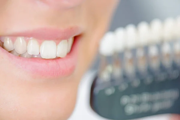 Perto de dentes — Fotografia de Stock