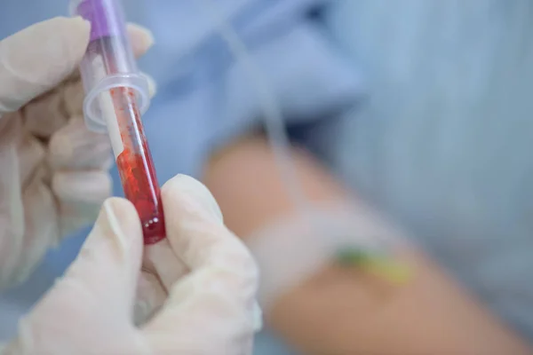 Close up van Injectieflacon van bloed — Stockfoto