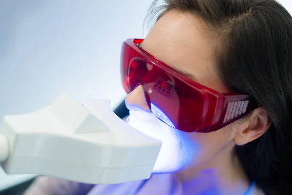 Фторування Відбілювання Зубів Допомогою Високотехнологічного Обладнання — стокове фото