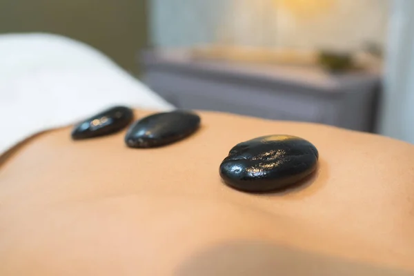 Doctor Puts Stones Womans Back Stone Therapy — Stock Photo, Image