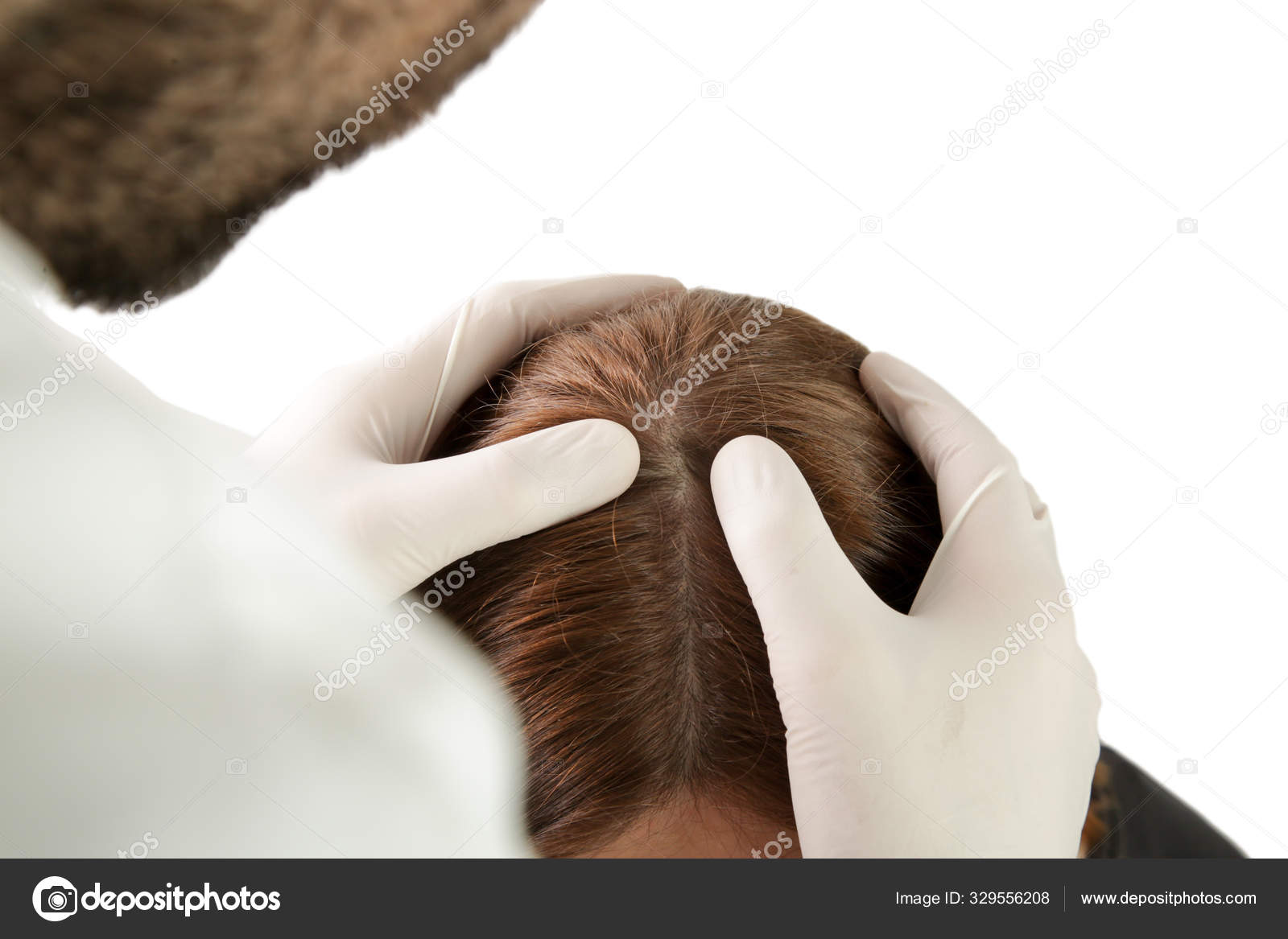 Doctor Examining Womans Hair Scalp Scalp Eczema Dermatitis Psoriasis Hair  Stock Photo by ©triocean2011 329556208