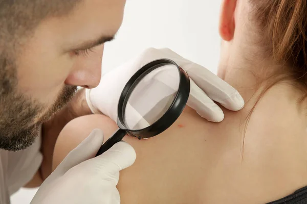 Dermatologist Checking Mole Magnifying Glass — 스톡 사진