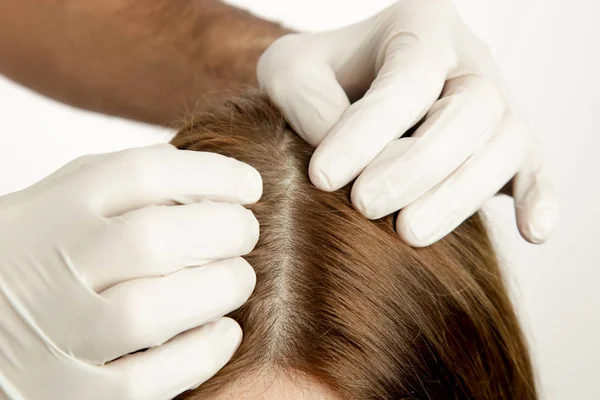 Medico Esaminando Cuoio Capelluto Delle Donne Eczema Del Cuoio Capelluto — Foto Stock