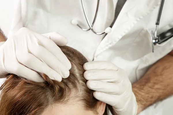 女性の髪の頭皮を調べる医師 頭皮湿疹 皮膚炎 ふけや乾燥頭皮の問題 — ストック写真