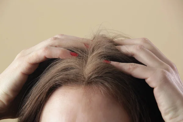 Nahaufnahme Einer Frau Die Natürliches Trockenshampoo Auf Haarwurzeln Verwendet Brunette — Stockfoto