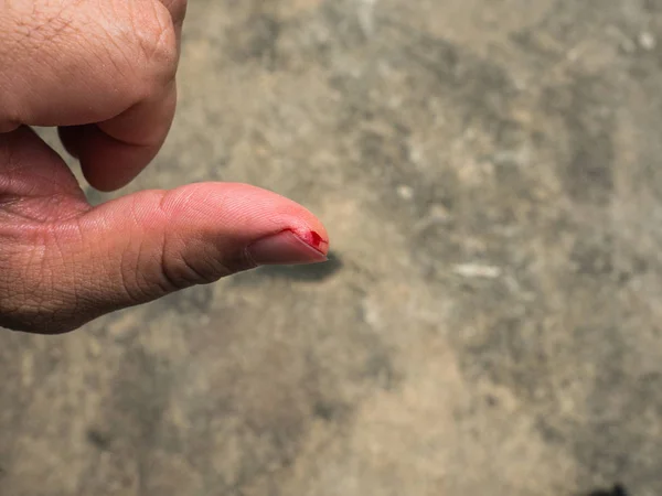 見積もりによって引き起こされる血流の左手の親指を配管の修理に注意しないでください。. — ストック写真
