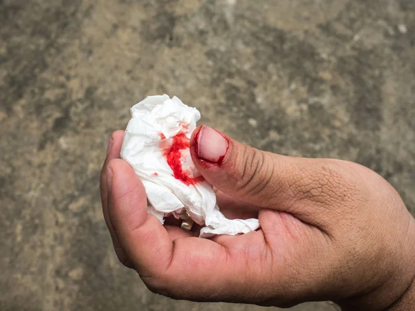 Papier à main pour doublure de sang. Du pouce gauche Le débit sanguin causé par l'estimation ne doit pas être prudent lors de la réparation de la plomberie . — Photo