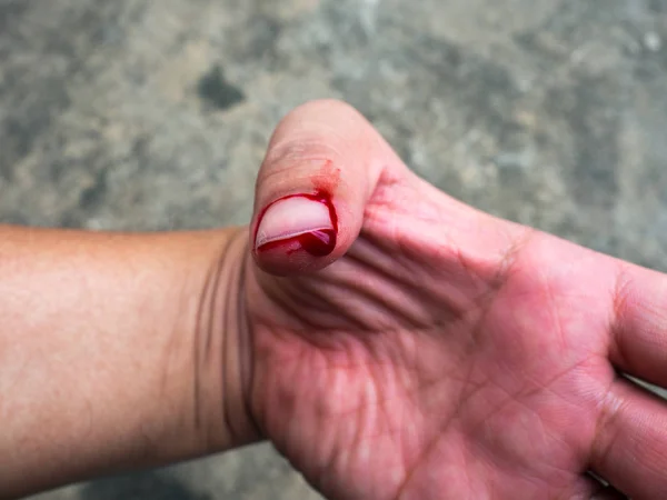 Pulgar izquierdo El flujo sanguíneo causado por la estimación no debe ser cauteloso en la reparación de la plomería . — Foto de Stock