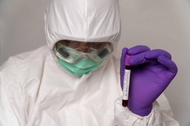 Koruyucu giysiler ve maskeli doktorlar Coronavirus salgını için pozitif kan testi yapıyorlar. Coronavirus 'u (COVID-19) tüm dünyaya yayma kavramı, ABD, Avrupa