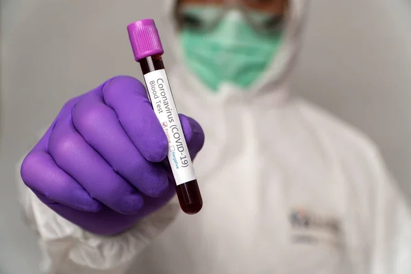 Médicos Dos Fatos Máscaras Protecção Estão Fazer Teste Sangue Positivo — Fotografia de Stock