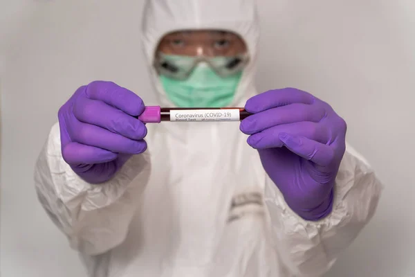 保護服やマスクの医師は 新しい急速に破壊コロナウイルスのための肯定的な血液検査結果を保持しています コロナウイルス Covid を世界 アメリカ ヨーロッパに広めるという概念 — ストック写真