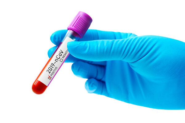 Chinese Corona Virus Blood Test Concept