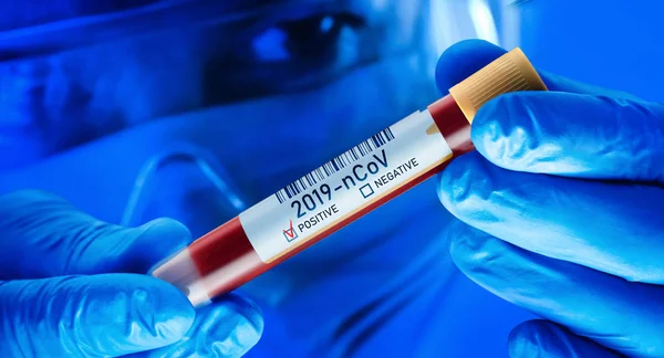 Chinese Corona Virus Blood Test Concept — Stok fotoğraf