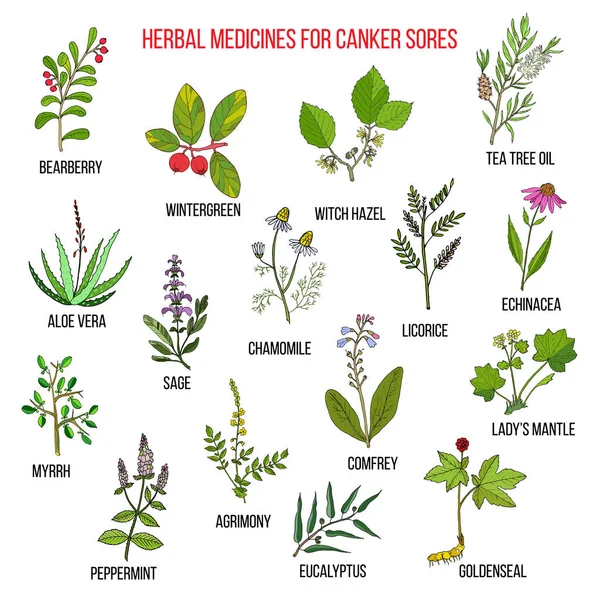 Los mejores remedios herbales para las úlceras bucales — Archivo Imágenes Vectoriales