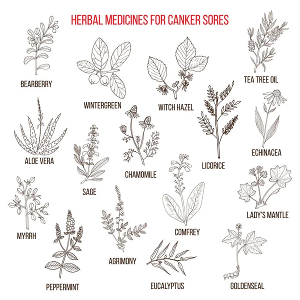 Los mejores remedios herbales para las úlceras bucales — Vector de stock
